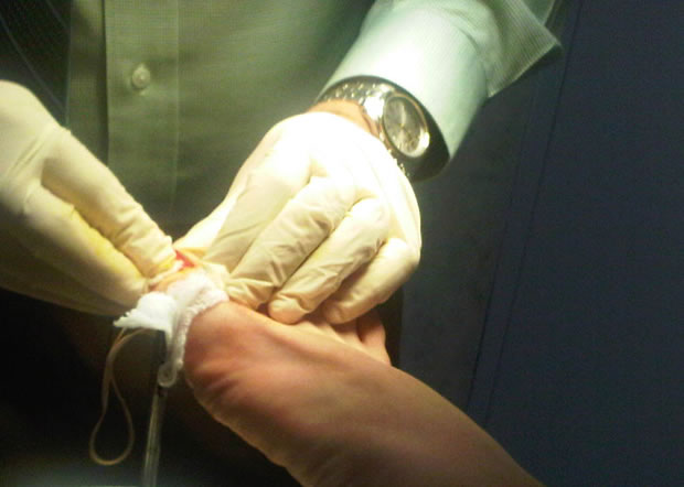 Cirugia de uñas enterradas